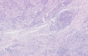 rak pod mikroskopem 2