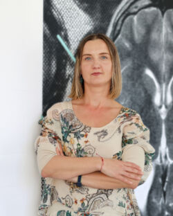 Grupa Badawcza Neuroplastyczności i Metabolizmu