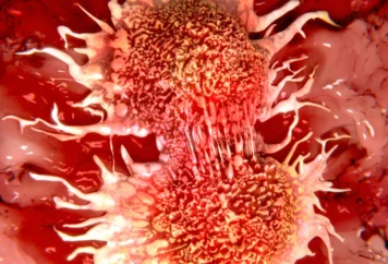cancer eucaim